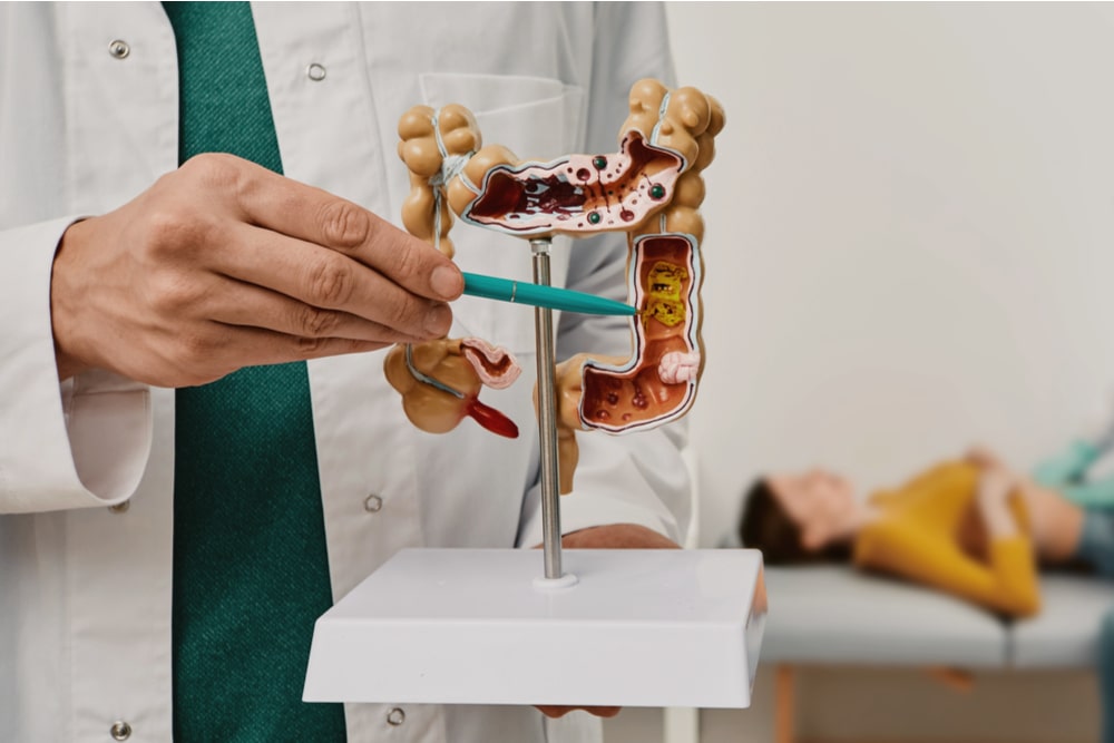 Anatomical intestines model with pathology in doctor hands